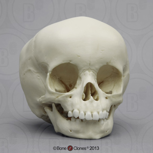 15-month-old Human Child Skull BC-111