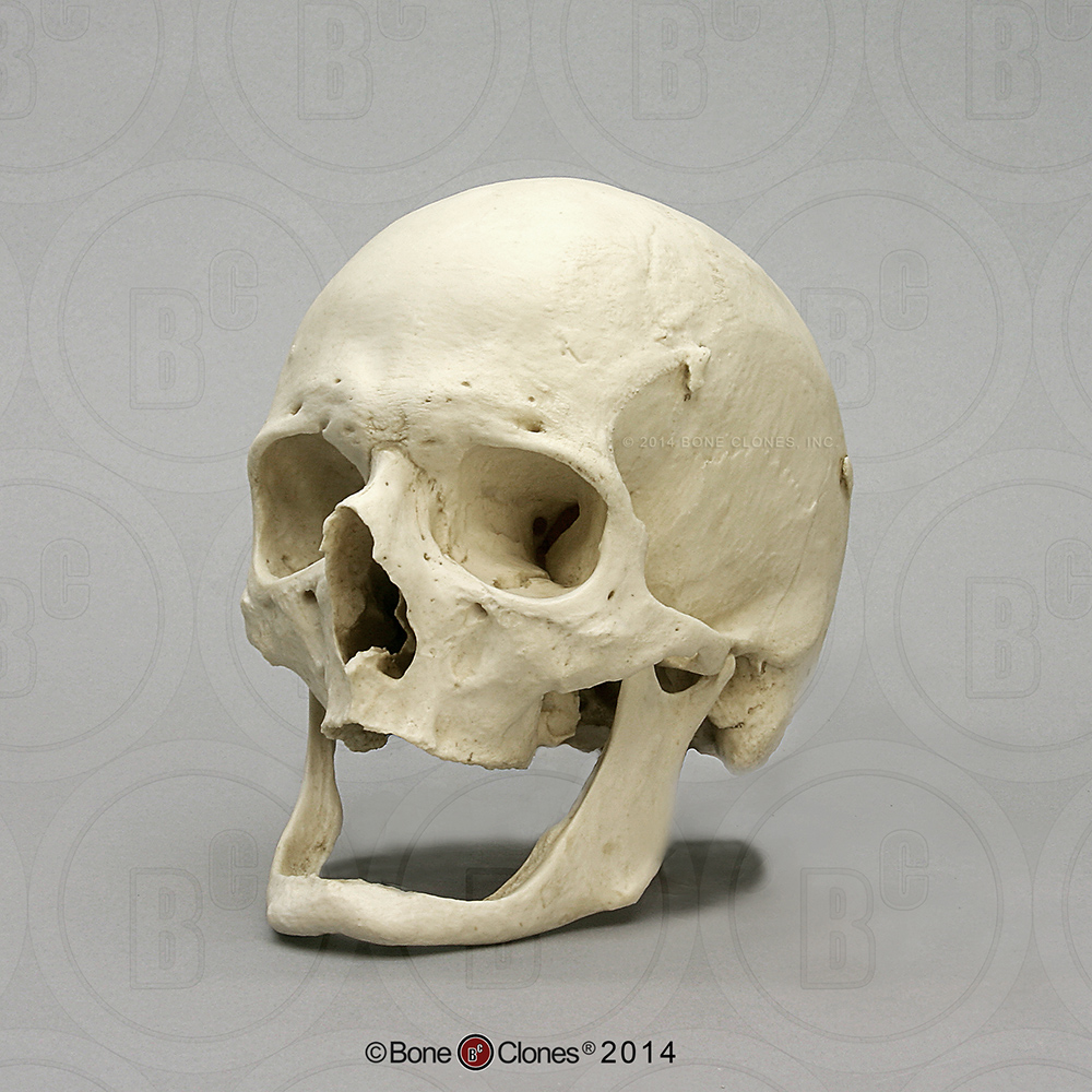 Human Elderly European Male Skull BC-204