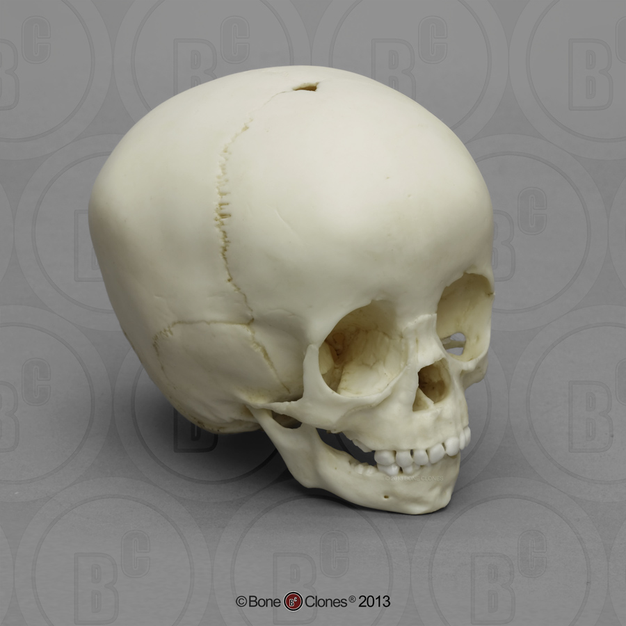 1 1/2-year-old Human Child Skull - Bone Clones, Inc. - Osteological