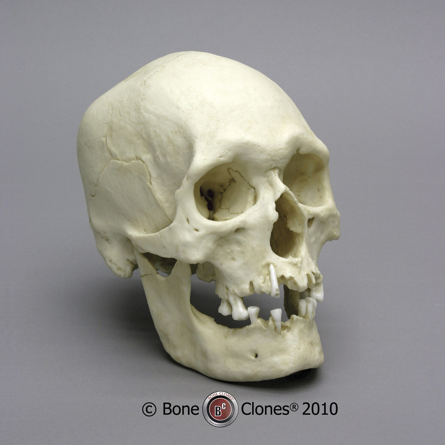 http://www.boneclones.com/images/bc-302-lg.jpg