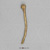 Homo neanderthalensis Shanidar 1 Humerus, atrophied KO-064 Homo neanderthalensis Shanidar 1 Humerus, atrophied KO-064