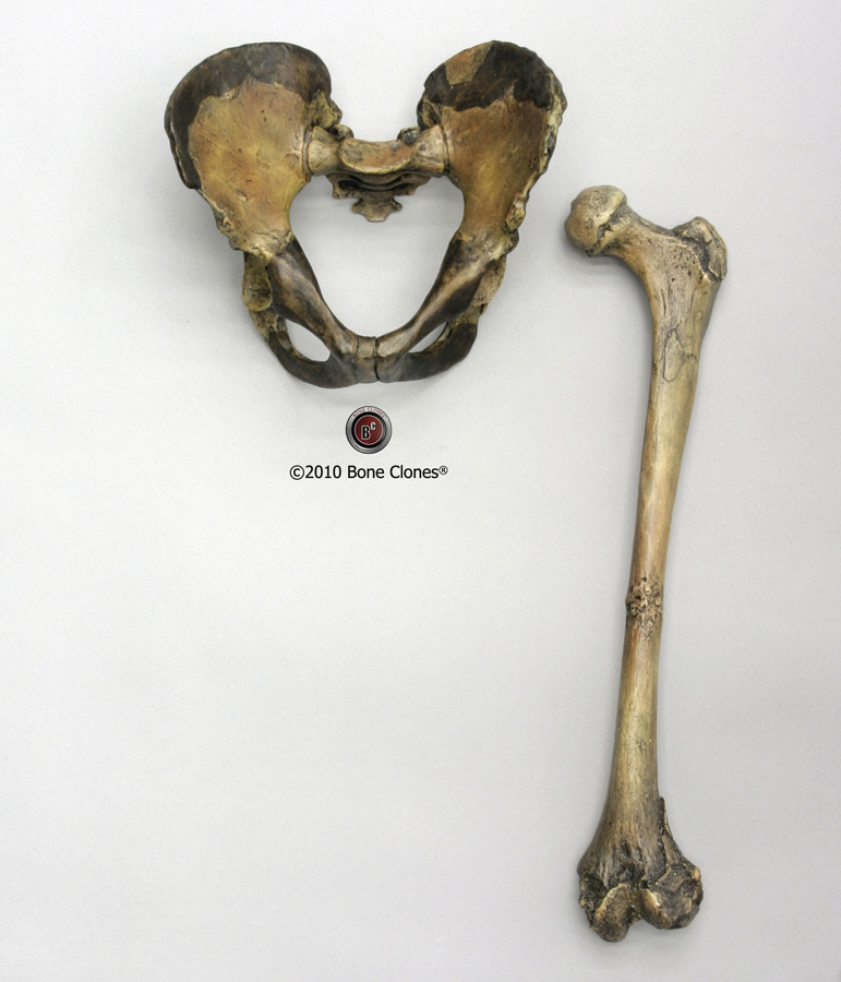 Human Femur Bone