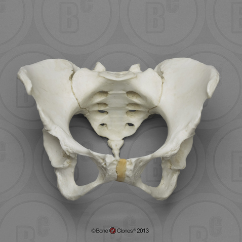 Articulated Female Pelvis with Features of Previous Pregnancy