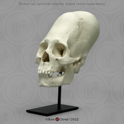 Human Peruvian Female Skull with Cranial Binding Human Peruvian Female Skull with Cranial Binding