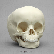 15-month-old Human Child Skull