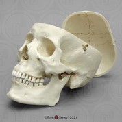 Modern Human Adult Asian Male Skull with Calvarium Cut
