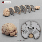 Human Brain Multiple Frontal Sections