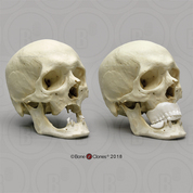 Human Skull for Facial Reconstruction, With Photo History