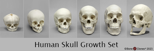 Human Skull Growth Set Human Skull Growth Set